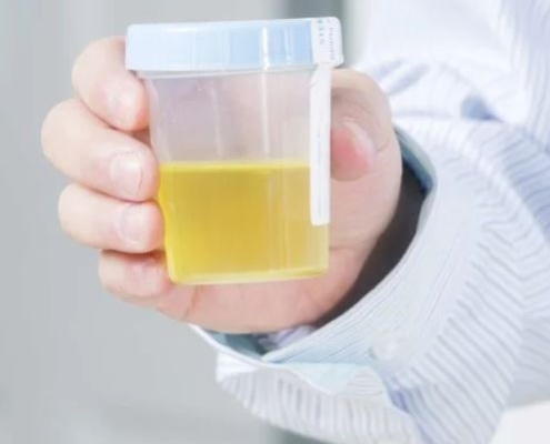 بررسی قاروره (آزمایش ادرار) به تشخیص بسیاری از بیماری‌ها کمک می‌کند.